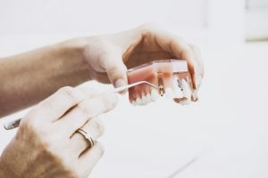 dental implant model